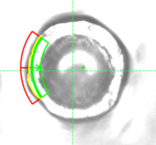 圖片7.png - 【工業精密量測】Wire bond（打線）量測方法