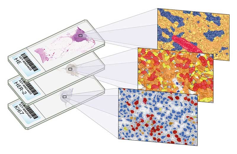 01-quantcenter_the-image-analysis-application_lowres.jpg - 【生命科學儀器】Ki67 / ER / PR / Her - 2 等多種癌症標記應用