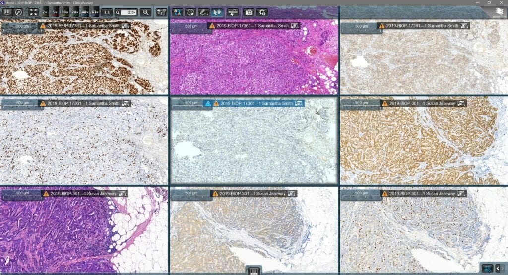 9-1024x555.jpg - Clinical Viewer 臨床閱片軟體