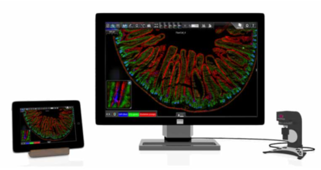 image.png - Case Viewer 數位玻片影像閱片軟體