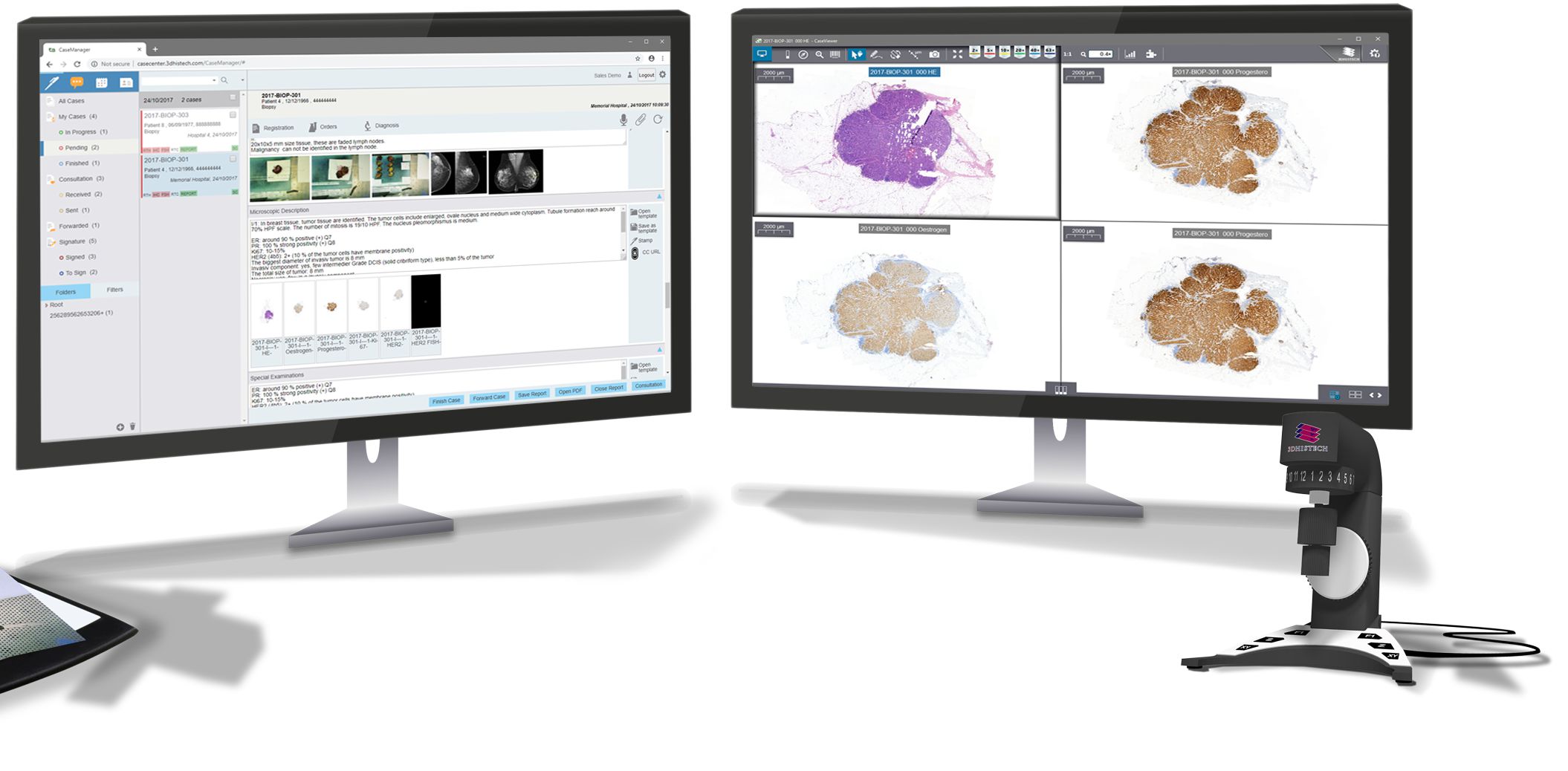Case Manager 病理影像管理暨報告平台系統 - 【數位病理臨床整體解決方案】