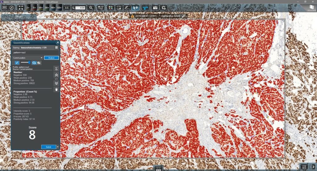 Diagnostic Application 協助診斷應用軟體（IVD認證） - 【數位病理臨床整體解決方案】