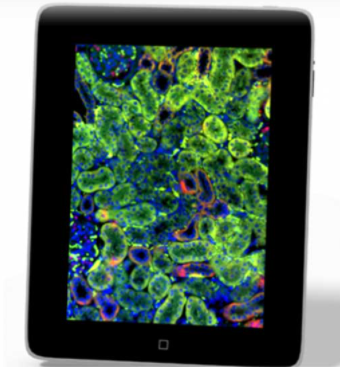 iPad Viewer / Instant Viewer 數位玻片影像閱片軟體（For iPad / MAC） - 【各式病理影像教學平台及考試系統】