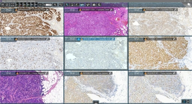 Case Viewer 數位玻片影像閱片軟體 - 【各式病理影像教學平台及考試系統】