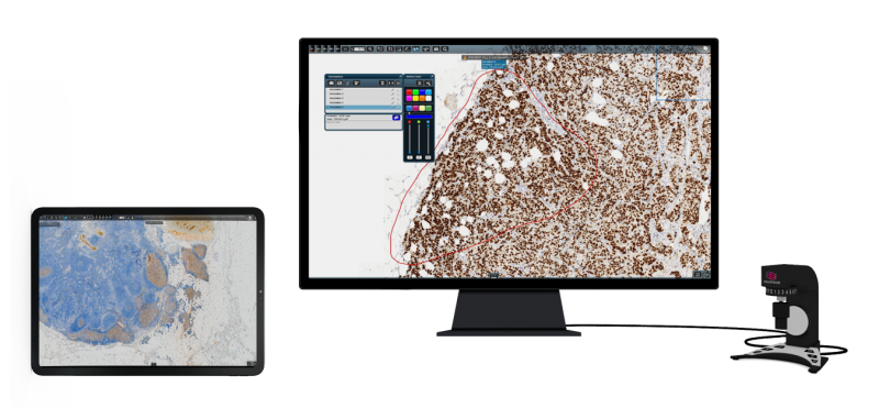 Slide Viewer 閱片軟體 Version 2.6（2022 年） - 【通用型全玻片影像整理解決方案】