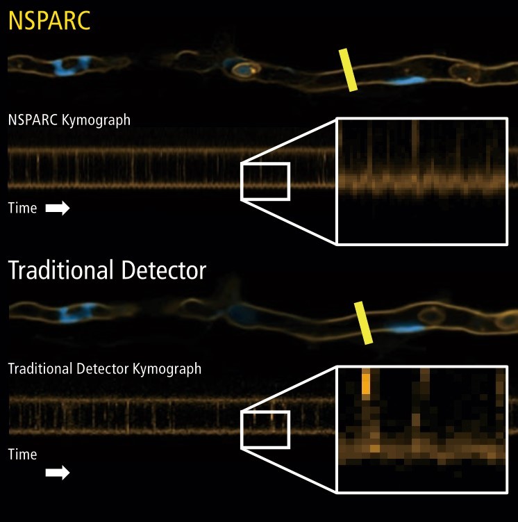 Nikon AX/AX R with NSPARC（Nikon SPatial ARray Confocal）