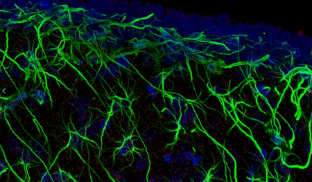 使用 Pannoramic Confocal Scanner 在 40 倍水鏡下的成像效果（來自 Confocal，鼠腦組織）
