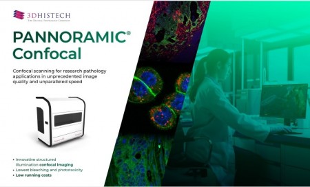 PANNORAMIC Confocal 使用 innovative structured illumination confocal imaging 來突破 Spinning Disk 技術上的限制。這提供了最高的光效能，同時將光漂白的效果降到最低（minimal bleaching）、掃描速度提升至最高。將 Colocalized imaging 技術用於螢光及明視野疊圖。