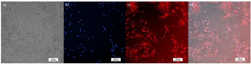 組成血腦屏障的三種細胞培養五天後的型態 - 星形膠質細胞 - 使用倒立顯微鏡