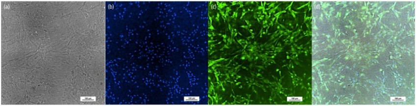 組成血腦屏障的三種細胞培養五天後的型態 - 周細胞 - 使用倒立顯微鏡