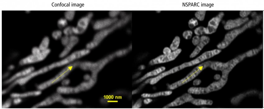 NSPARC 與傳統 Confocal 的影像比較