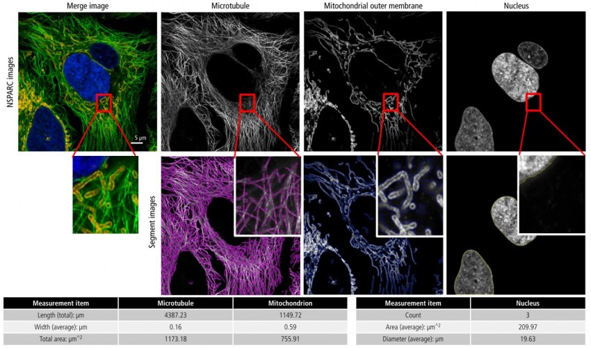 超解析影像 - 微管與粒線體定量分析